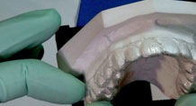 Q100